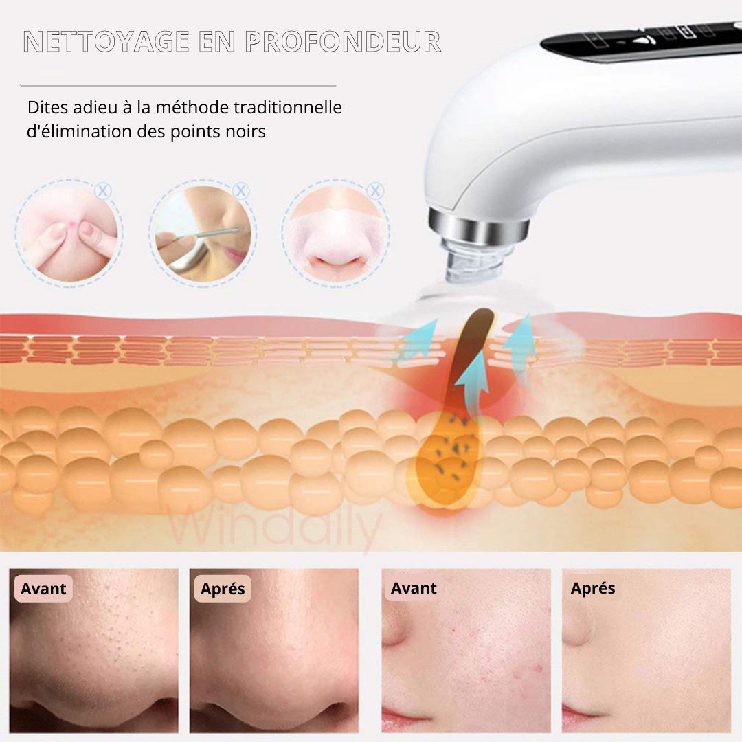 PerfectClean™ - Appareil De Nettoyage Du Visage à Micro Petites Bulles - Innocent-Seduction